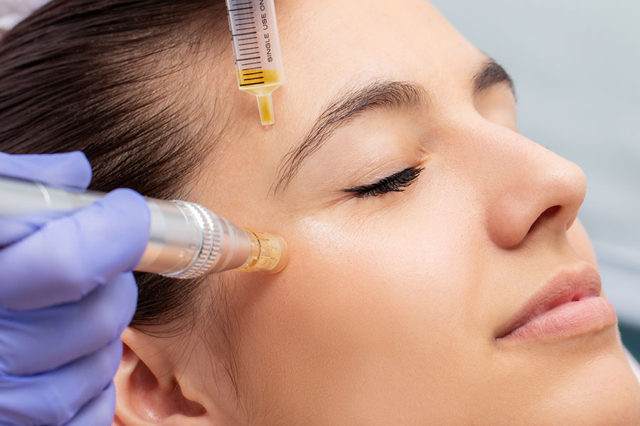 PRP Therapy